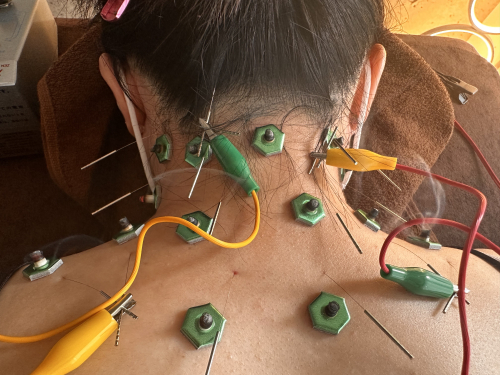 鍼灸サロン のんのこだわりポイント