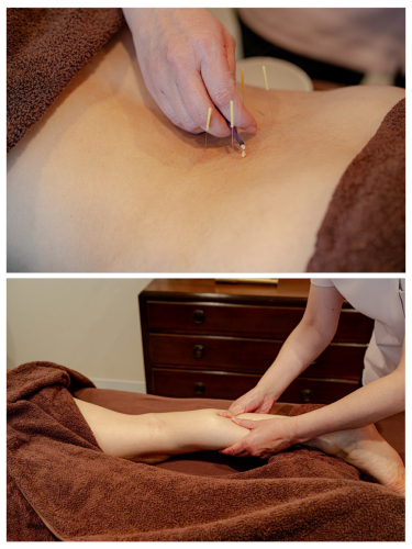 レディース鍼灸院Perchのこだわりポイント