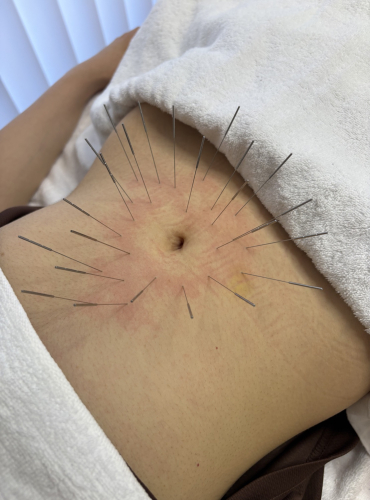 はりきゅう春信堂　松戸院のこだわりポイント