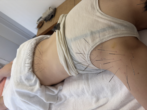 はりきゅう春信堂　松戸院のこだわりポイント