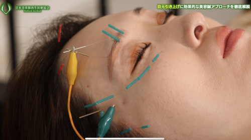 HaRick 美容鍼灸整体のこだわりポイント