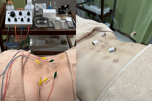 てあてる我孫子鍼灸マッサージ院のこだわりポイント