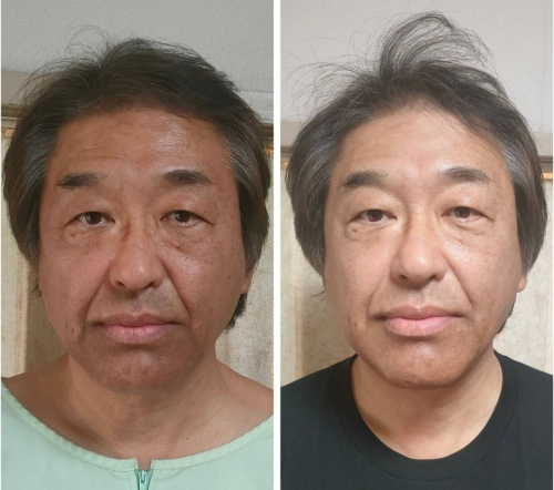 山本鍼灸院のこだわりポイント