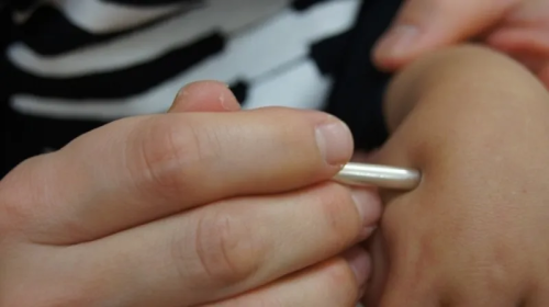 はりときゅう　千里山あはひのこだわりポイント