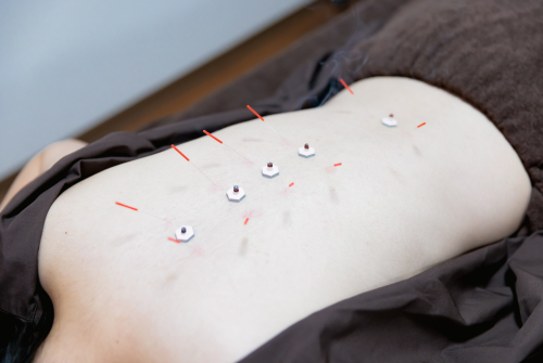 【女性専門】つるみ四季の声はりきゅう治療院のこだわりポイント