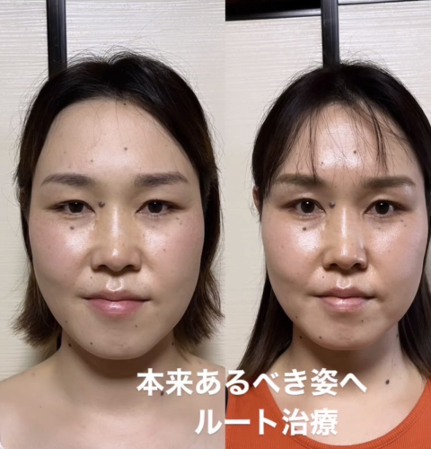 鍼処FUJINUMA 東京院のこだわりポイント