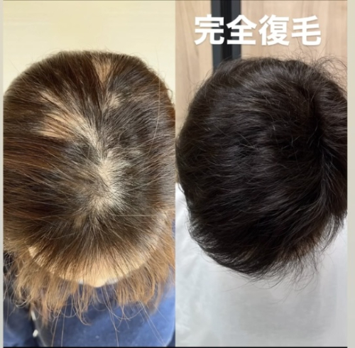 鍼処FUJINUMA 東京院のこだわりポイント