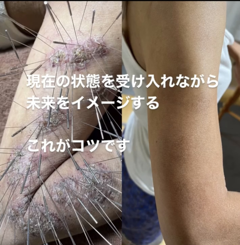 鍼処FUJINUMA 東京院のこだわりポイント