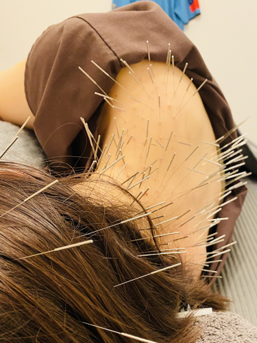 Crazy鍼灸整体院　烏丸御池院のこだわりポイント