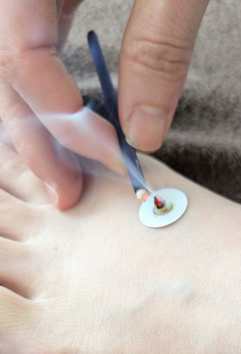 はり灸　Mysigのこだわりポイント