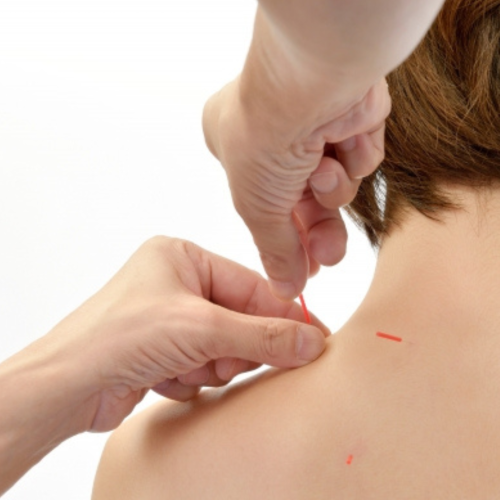 山本鍼療所のこだわりポイント