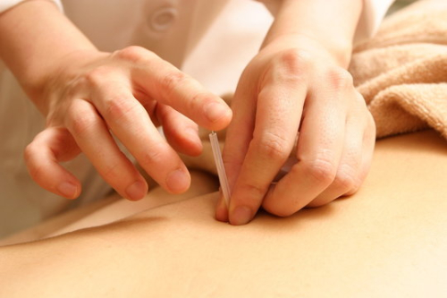 出水  美温はりきゅう院のこだわりポイント