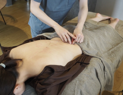 はりきゅう きざしのこだわりポイント