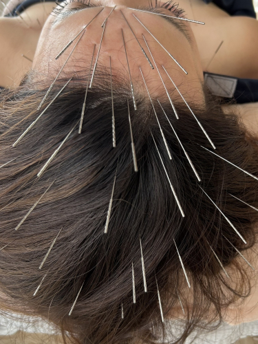 鍼灸soin de beauteのこだわりポイント