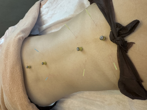 鍼灸soin de beauteのこだわりポイント