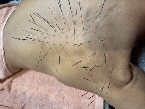 鍼灸soin de beauteのこだわりポイント