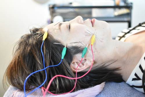 こくまはりきゅう院のこだわりポイント