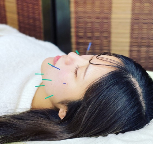 松本接骨院・はり灸院のこだわりポイント