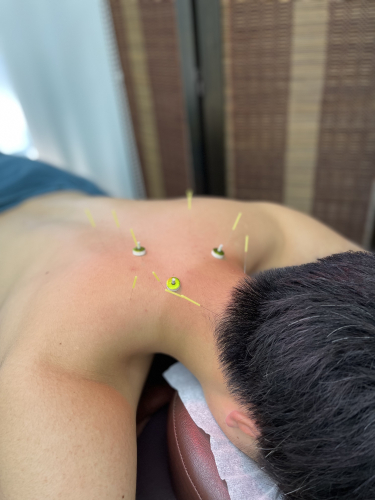 松本接骨院・はり灸院のこだわりポイント