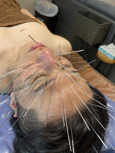 賢鍼灸院(ルート治療)のこだわりポイント