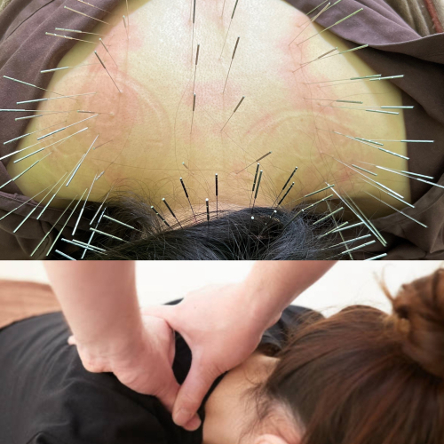 たいよう鍼灸整骨院conditioning labo(ルート治療認定院)のこだわりポイント