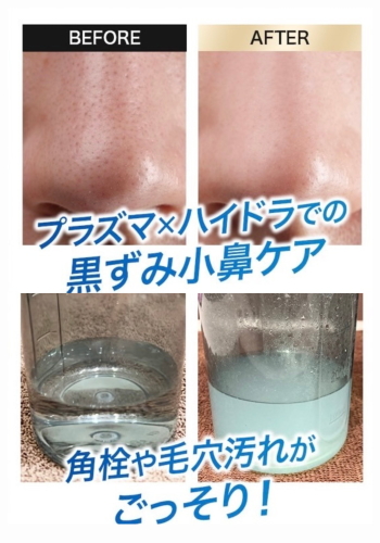 鍼灸サロン　ねこのてのこだわりポイント