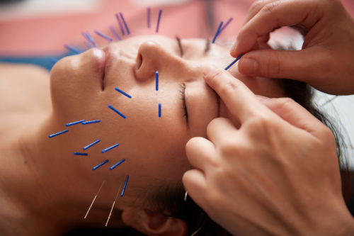 美楽鍼のこだわりポイント