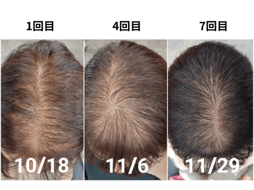 美容とカラダの鍼灸サロン やなけん 亀戸店のこだわりポイント