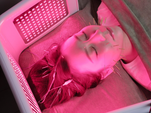 美容とカラダの鍼灸サロン やなけん 亀戸店のこだわりポイント