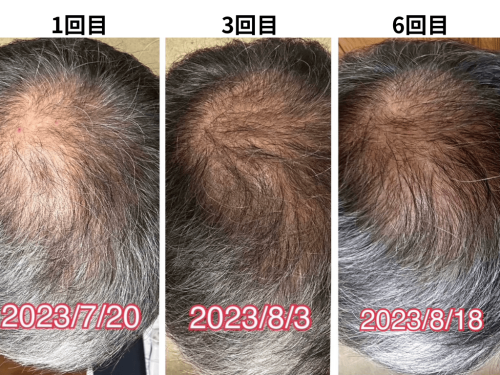 美容とカラダの鍼灸サロン やなけん 亀戸店のこだわりポイント