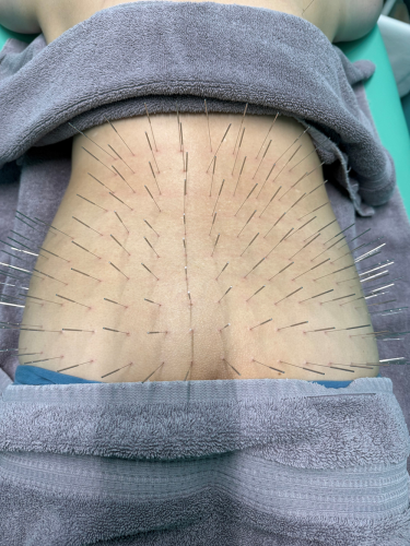 ルート治療福岡のこだわりポイント