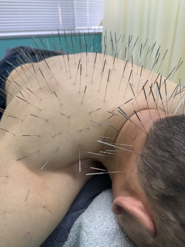 ルート治療福岡のこだわりポイント