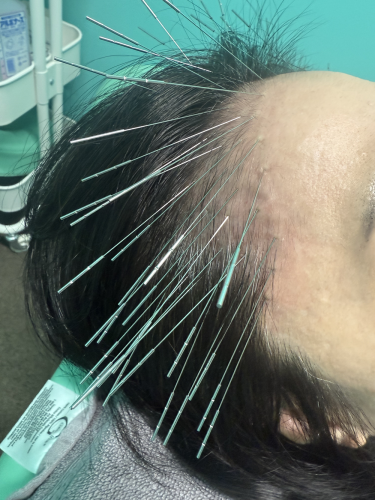 ルート治療福岡のこだわりポイント