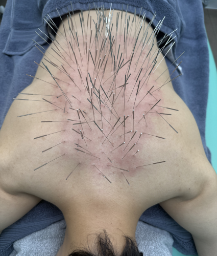 ルート治療福岡のこだわりポイント