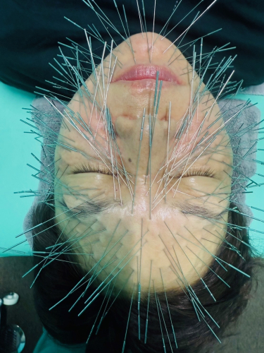 ルート治療福岡のこだわりポイント