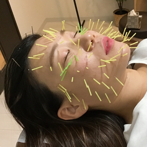 肌質改善専門 美容鍼デイジ―所沢店のこだわりポイント