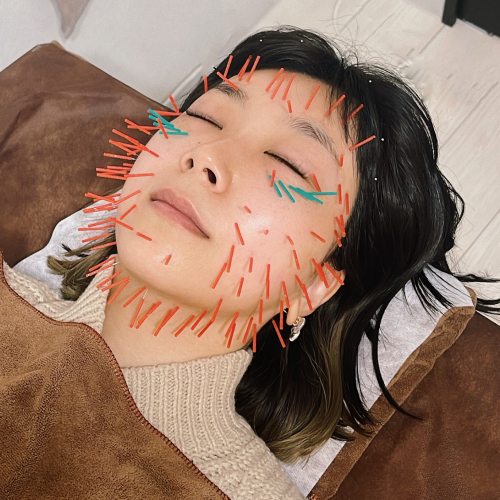 肌質改善専門 美容鍼デイジ―所沢店のこだわりポイント