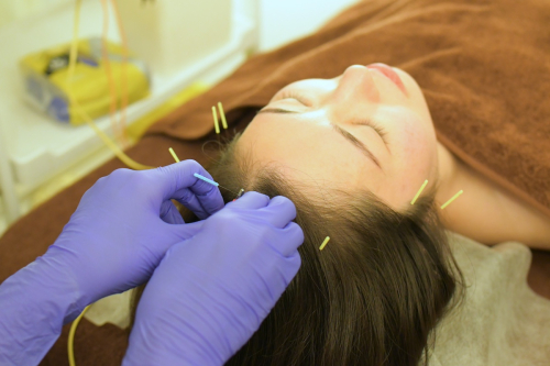 Aire鍼灸院のこだわりポイント