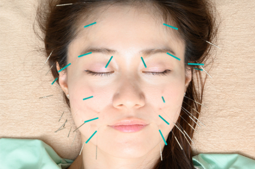 はり灸院こうえいのこだわりポイント