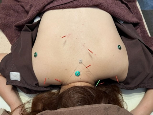 おひさま堂鍼灸治療院のこだわりポイント