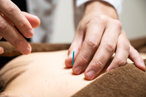 extend～鍼灸マッサージ院～のこだわりポイント