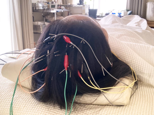 新駒鍼灸院のこだわりポイント