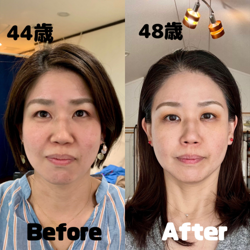 鍼処卓-taku- ｜ルート治療Sランク公認認定院｜空ルート｜浄化｜美容鍼｜吹田市のこだわりポイント