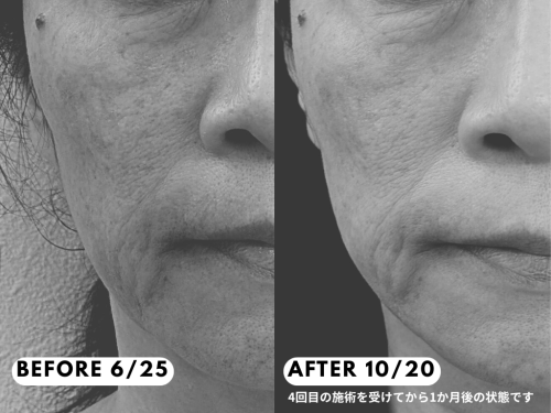 はりきゅうeFu -エフ-のこだわりポイント