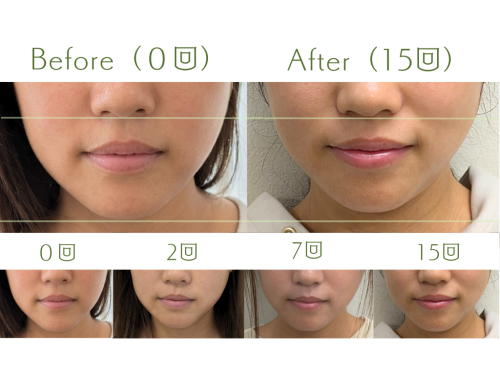 はりきゅうeFu -エフ-のこだわりポイント