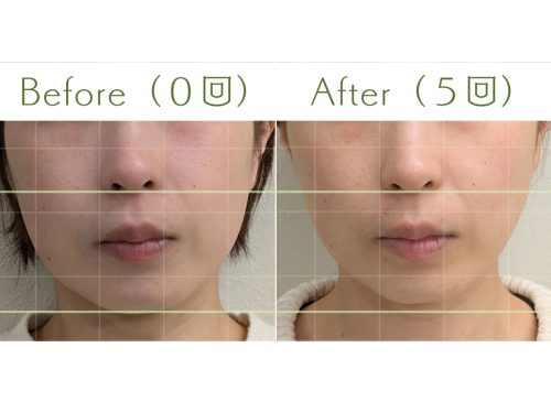 はりきゅうeFu -エフ-のこだわりポイント