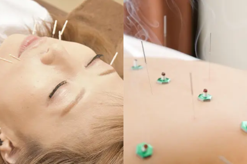 はりきゅう院　歩のこだわりポイント