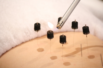 鍼灸院　和のこだわりポイント