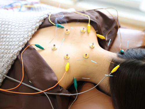 鍼灸サロンHariBearのこだわりポイント