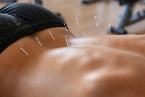 浦添てるてる鍼灸整骨院×teru.fitのこだわりポイント